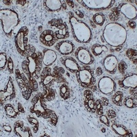 Cytokeratin 8 Mouse Monoclonal Antibody