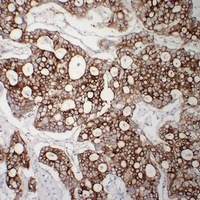Cytokeratin 8 Mouse Monoclonal Antibody