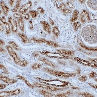 Cytokeratin 8 Mouse Monoclonal Antibody