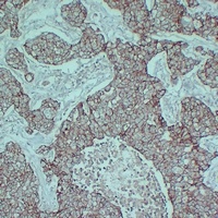E Cadherin Mouse Monoclonal Antibody