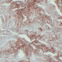GLUT1 Mouse Monoclonal Antibody