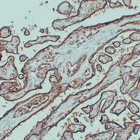 Anti-GLUT1 Antibody