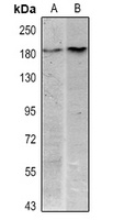 HER2 Antibody