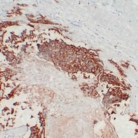 HER2 Antibody