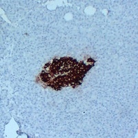 Insulin Mouse Monoclonal Antibody