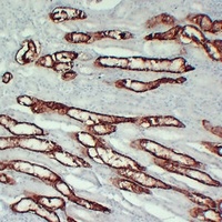 Anti-KSP Cadherin Antibody