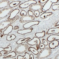 Anti-KSP Cadherin Antibody