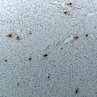 Tryptase alpha/beta Mouse Monoclonal Antibody