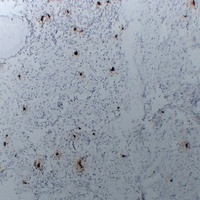 Tryptase alpha/beta Mouse Monoclonal Antibody