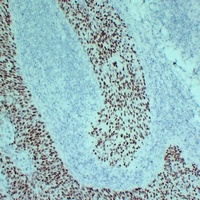 p63 Antibody