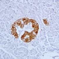 Anti-PGP9.5 Antibody