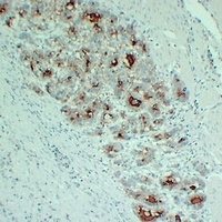 PI3K p110 alpha (H1047R) Antibody