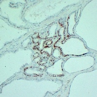 S100-A6 antibody