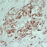 S100-P Mouse Monoclonal Antibody