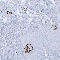 Somatostatin Mouse Monoclonal Antibody