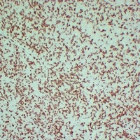 ZAP70 Mouse Monoclonal Antibody