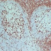 ZAP70 Mouse Monoclonal Antibody