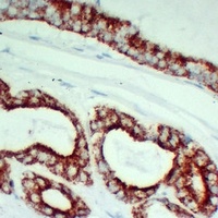 Anti-AMACR Antibody