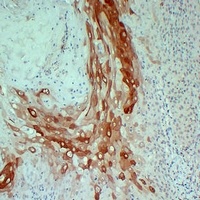 Cytokeratin 10 Mouse Monoclonal Antibody