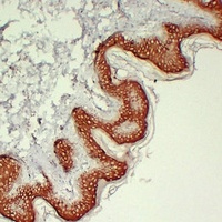 Cytokeratin 10 Mouse Monoclonal Antibody