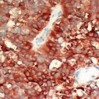 FSH beta Antibody