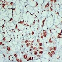 PIP antibody