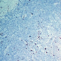 Myeloperoxidase Mouse Monoclonal Antibody