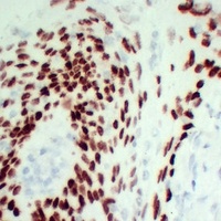 p63 Mouse Monoclonal Antibody
