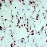 Progesterone Receptor Mouse Monoclonal Antibody