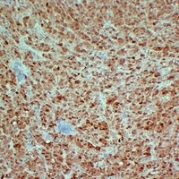 S100-B Mouse Monoclonal Antibody
