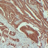 Beta-catenin Mouse Monoclonal Antibody
