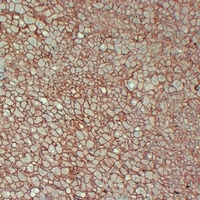 Beta-catenin Mouse Monoclonal Antibody