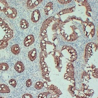 Beta-catenin Mouse Monoclonal Antibody