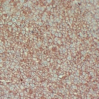 Beta-catenin Mouse Monoclonal Antibody