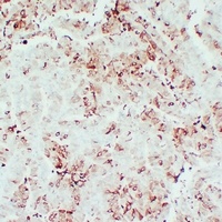 Anti-PGHS-2 Antibody