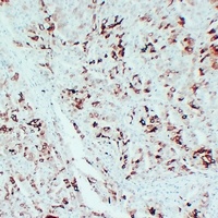 Anti-PGHS-2 Antibody