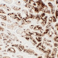 TMPase Mouse Monoclonal Antibody