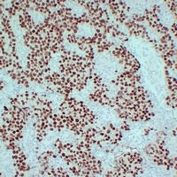 SALL4 antibody