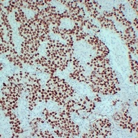 Anti-SALL4 Antibody