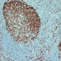 Anti-STMN1 Antibody