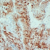 Arginase 1 Mouse Monoclonal Antibody