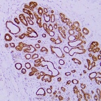 Catenin delta 1 antibody