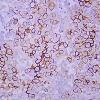 Mesothelin Mouse Monoclonal Antibody