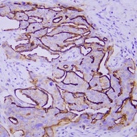 Mesothelin Mouse Monoclonal Antibody