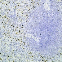 Perforin 1 Mouse Monoclonal Antibody