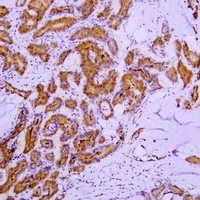 Galectin 3 Mouse Monoclonal Antibody