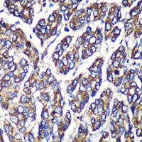 UGT1A1 Antibody