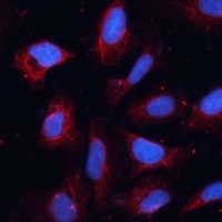 Anti-ANO1 Antibody