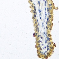 Anti-Cochlin Antibody