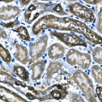 Anti-BNP Antibody